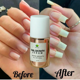 NAIL GROWTH SERUM (RAPID GROWTH)