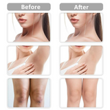 Under Arms Whitening Cream ( LIGHTEN UP  PRIVATE PARTS )