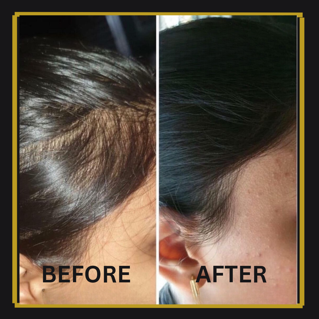 NOURSHING HAIR GROWTH ELIXIR (120ML)