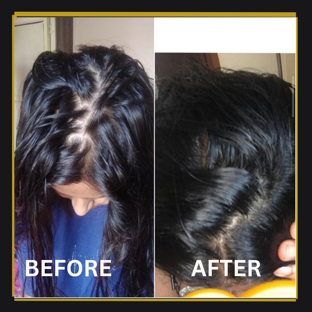 NOURSHING HAIR GROWTH ELIXIR (120ML)