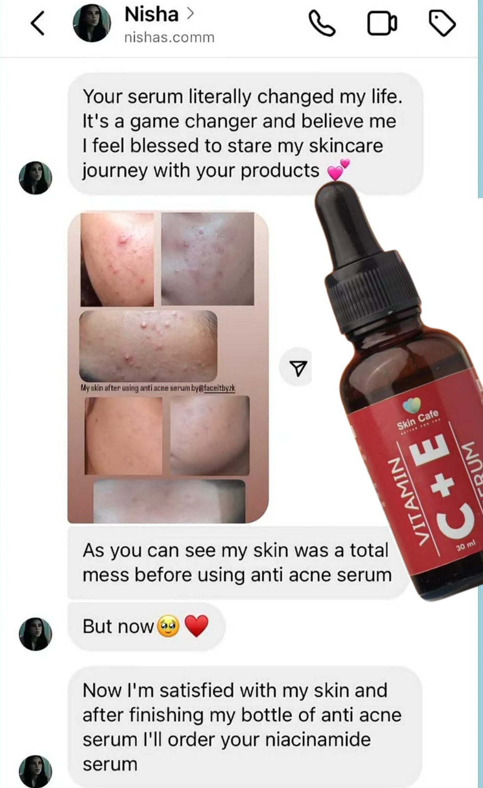 ANTI ACNE & GLOWING SERUM VITAMIN C + E