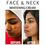 FACE & NECK WHITENING CREAM