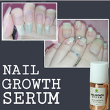 NAIL GROWTH SERUM (RAPID GROWTH)