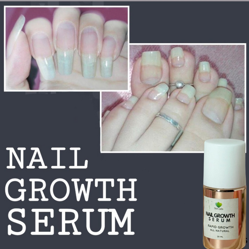 NAIL GROWTH SERUM (RAPID GROWTH)