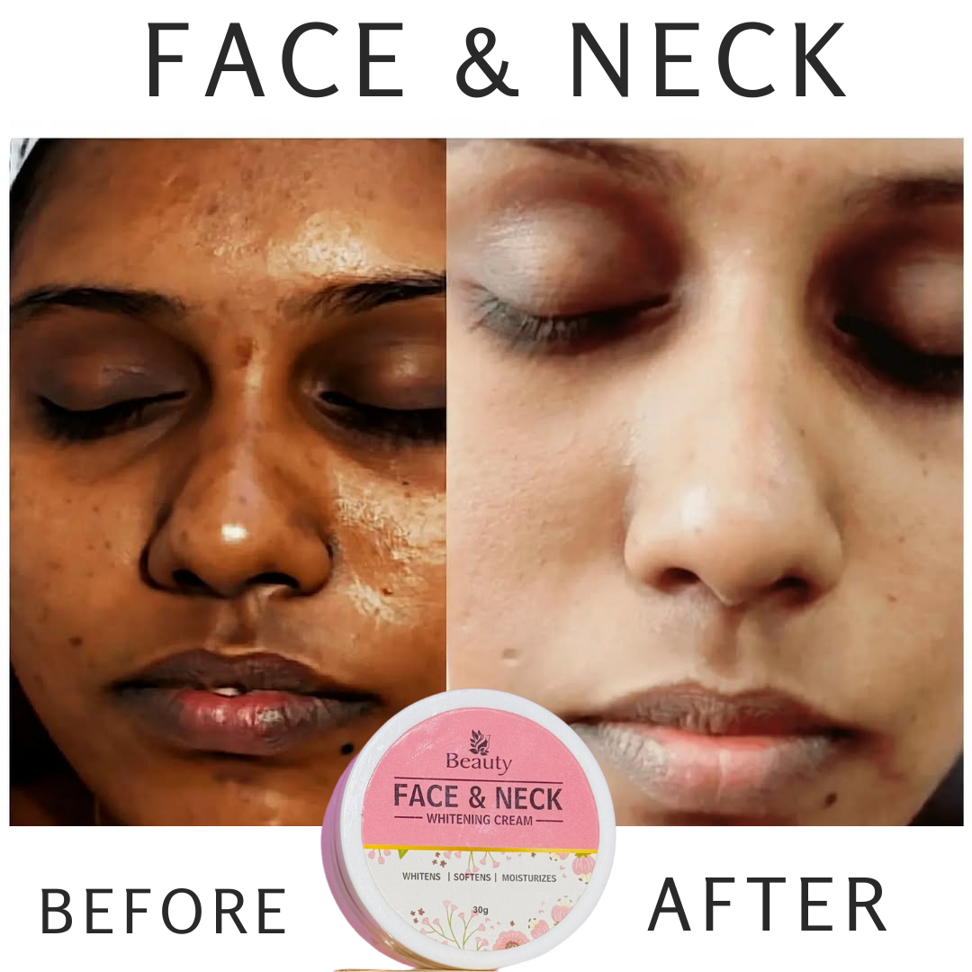 FACE & NECK WHITENING CREAM