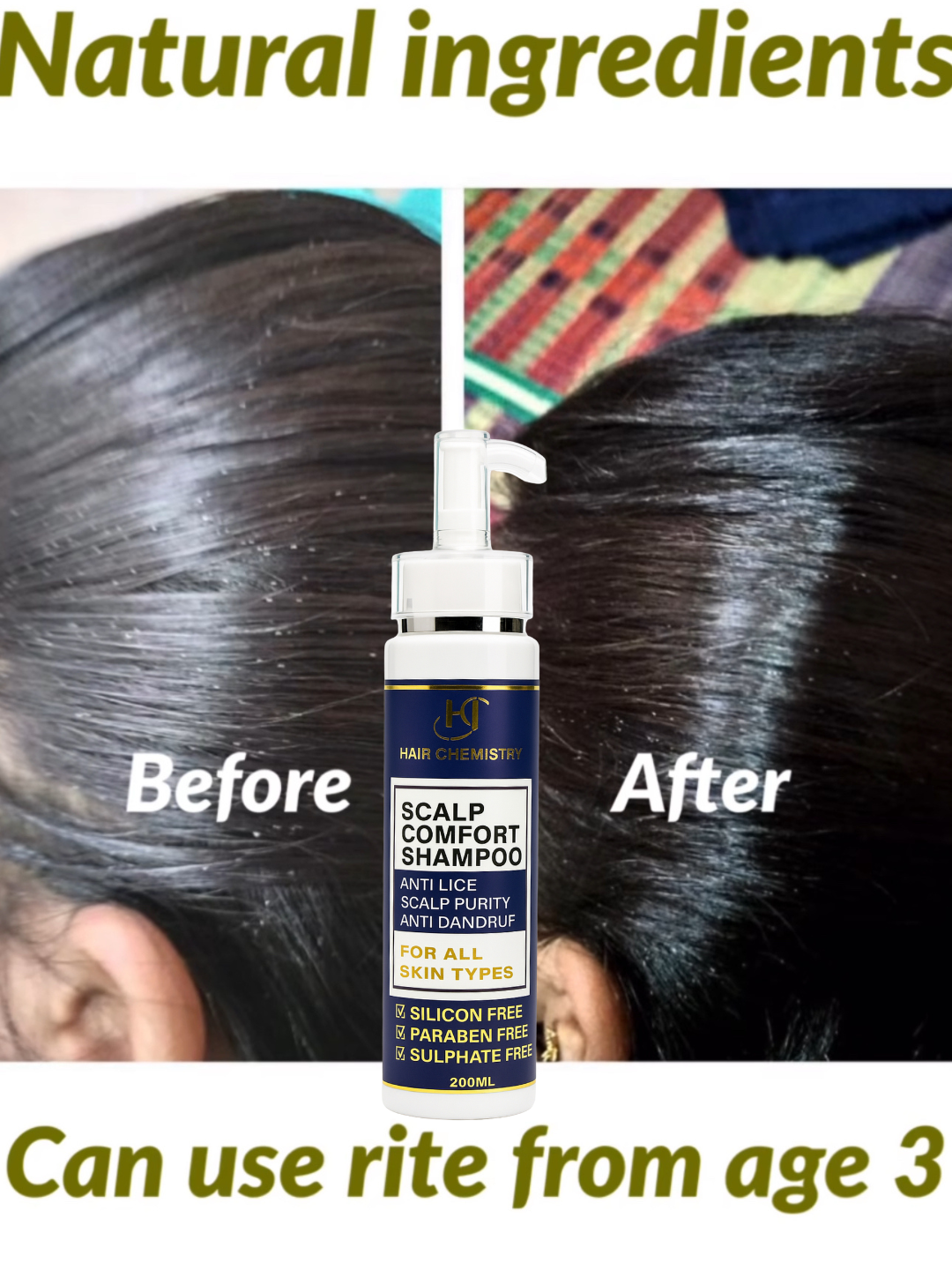 Anti-Lice Shampoo 200ml ( PREMIUM QUALITY )