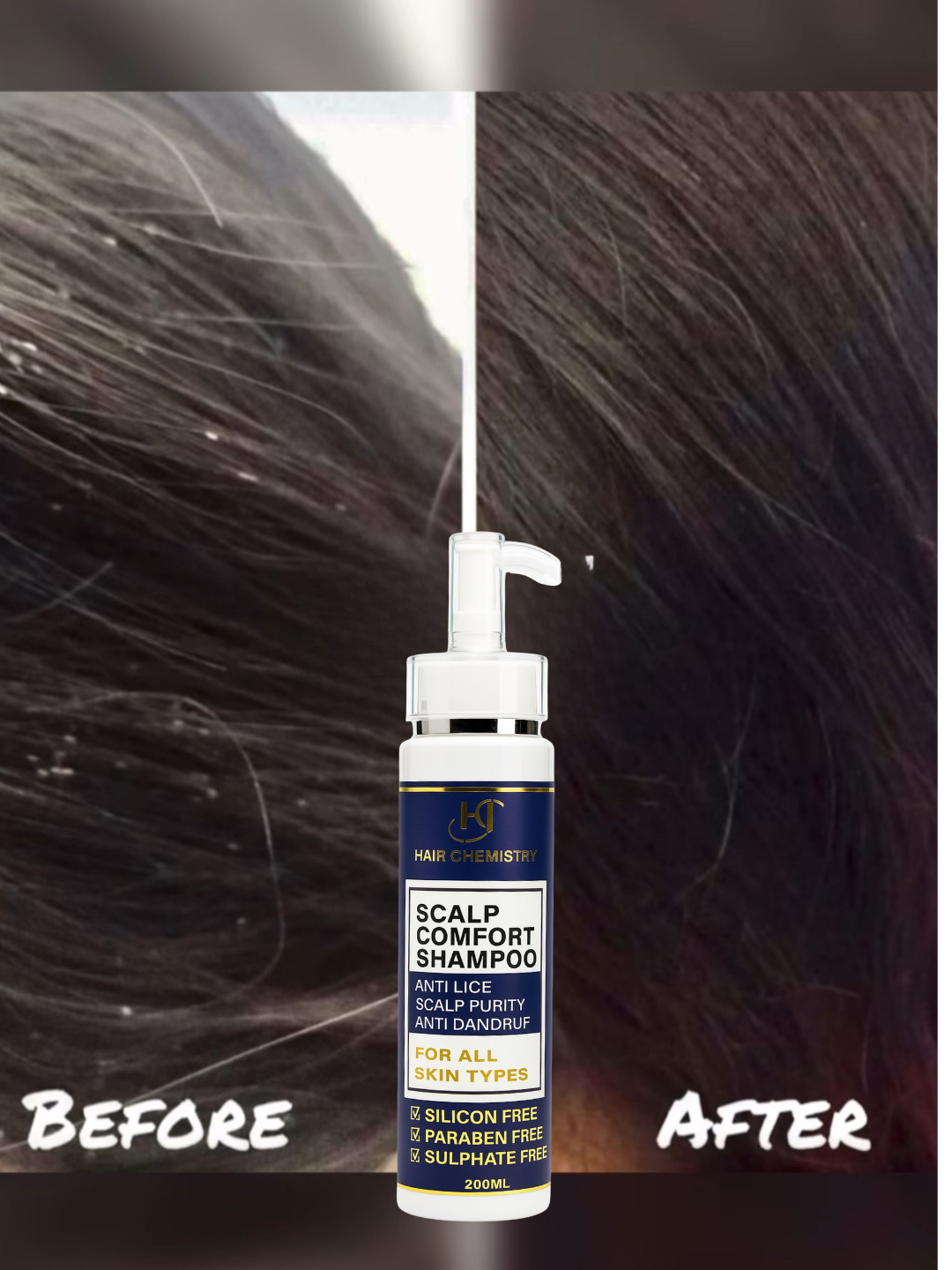 Anti-Lice Shampoo 200ml ( PREMIUM QUALITY )