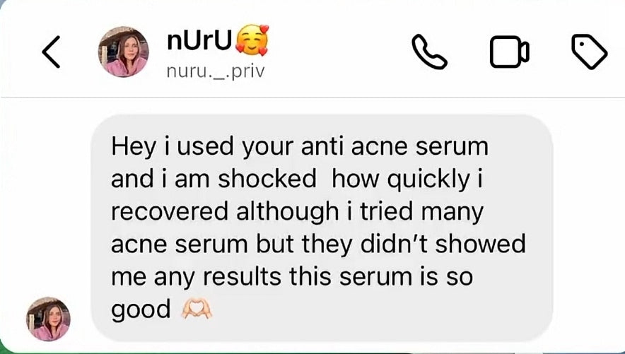 ANTI ACNE & GLOWING SERUM VITAMIN C + E