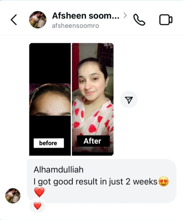 ANTI ACNE & GLOWING SERUM VITAMIN C + E