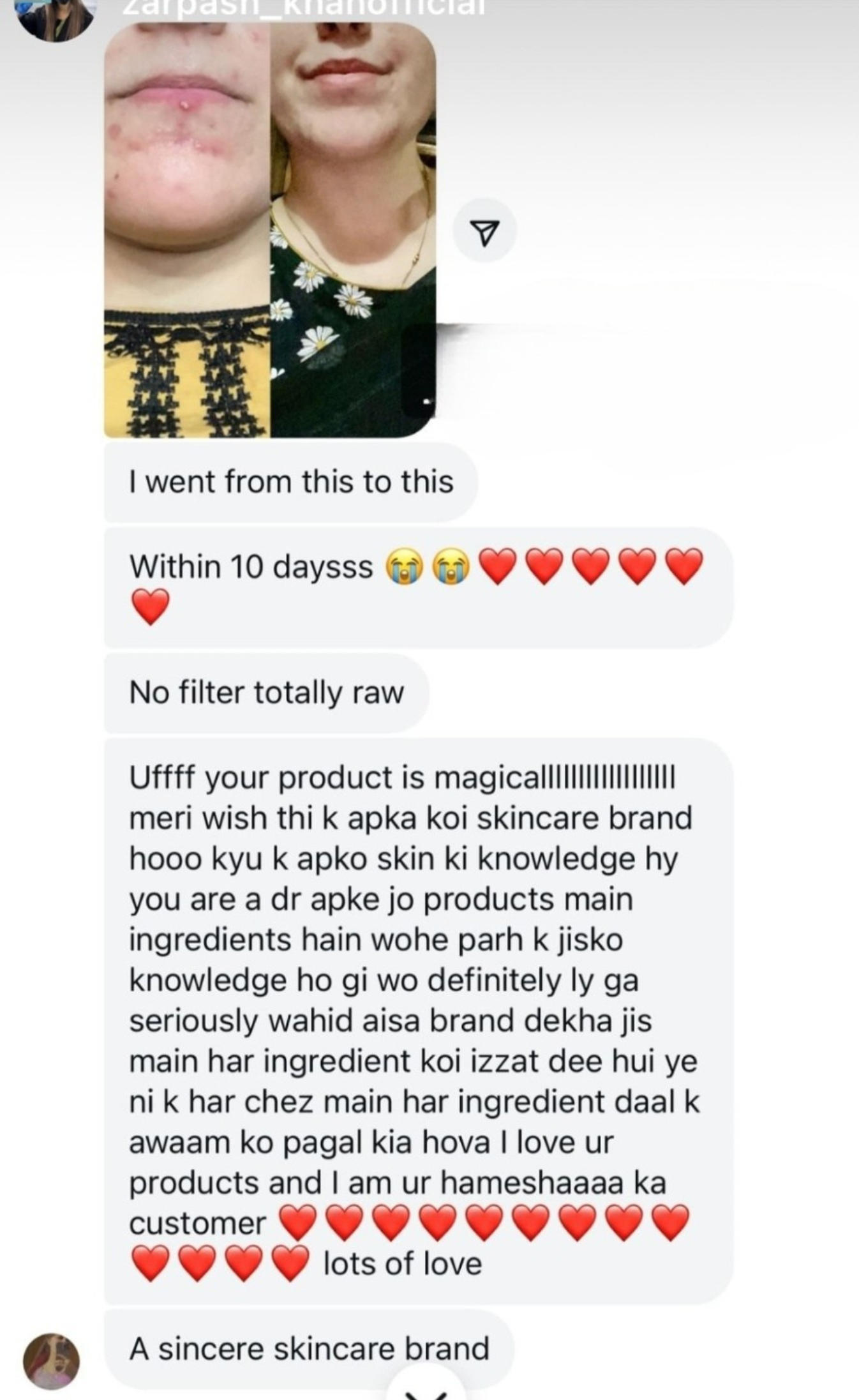 ANTI ACNE & GLOWING SERUM VITAMIN C + E